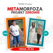 Pani Teresie po roku współpracy z Gabinetem Projekt Zdrowie Stalowa Wola udało się zrzucić 25 kg!