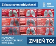 Urządzenie ustawiane jest zazwyczaj na dwa tygodnie w różnych lokalizacjach, gdzie pokrywa się pyłem i w zależności od poziomu zanieczyszczenia powietrza przybiera kolory od grafitowego po czarny.