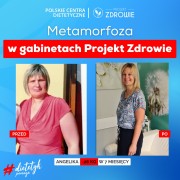 Postanowienia mijają, nawyki zostają. Bezpłatne konsultacje dietetyczne w Stalowej Woli.