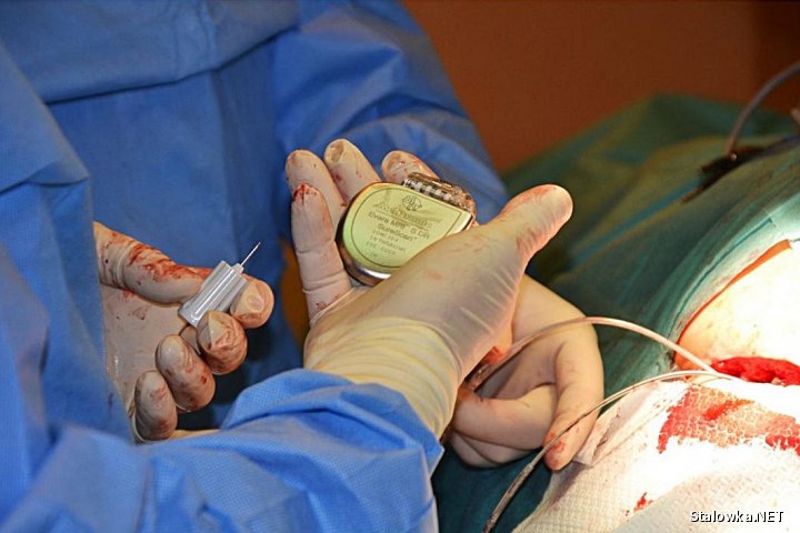 Kardiolodzy stalowowolskiego szpitala: Zbigniew Hyła i Jerzy Ozga, wykonali w miniony piątek, 12 grudnia, dwa zabiegi wszczepienia nowego typu kardiowertera - defibrylatora Evera MRITM.